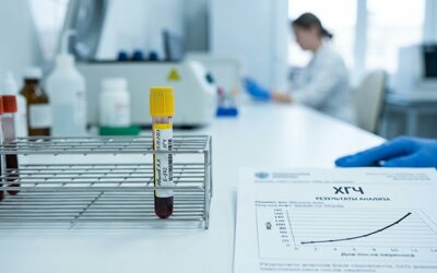 Снижение уровня ХГЧ у беременных женщин